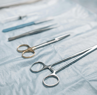 Видалення зовнішніх тромбованих гемороїдальних вузлів