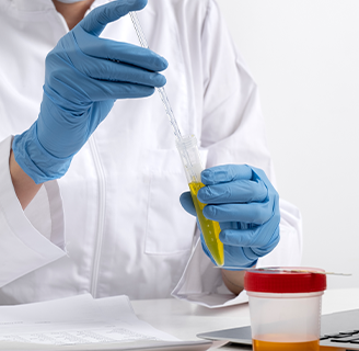 Аналіз сечі