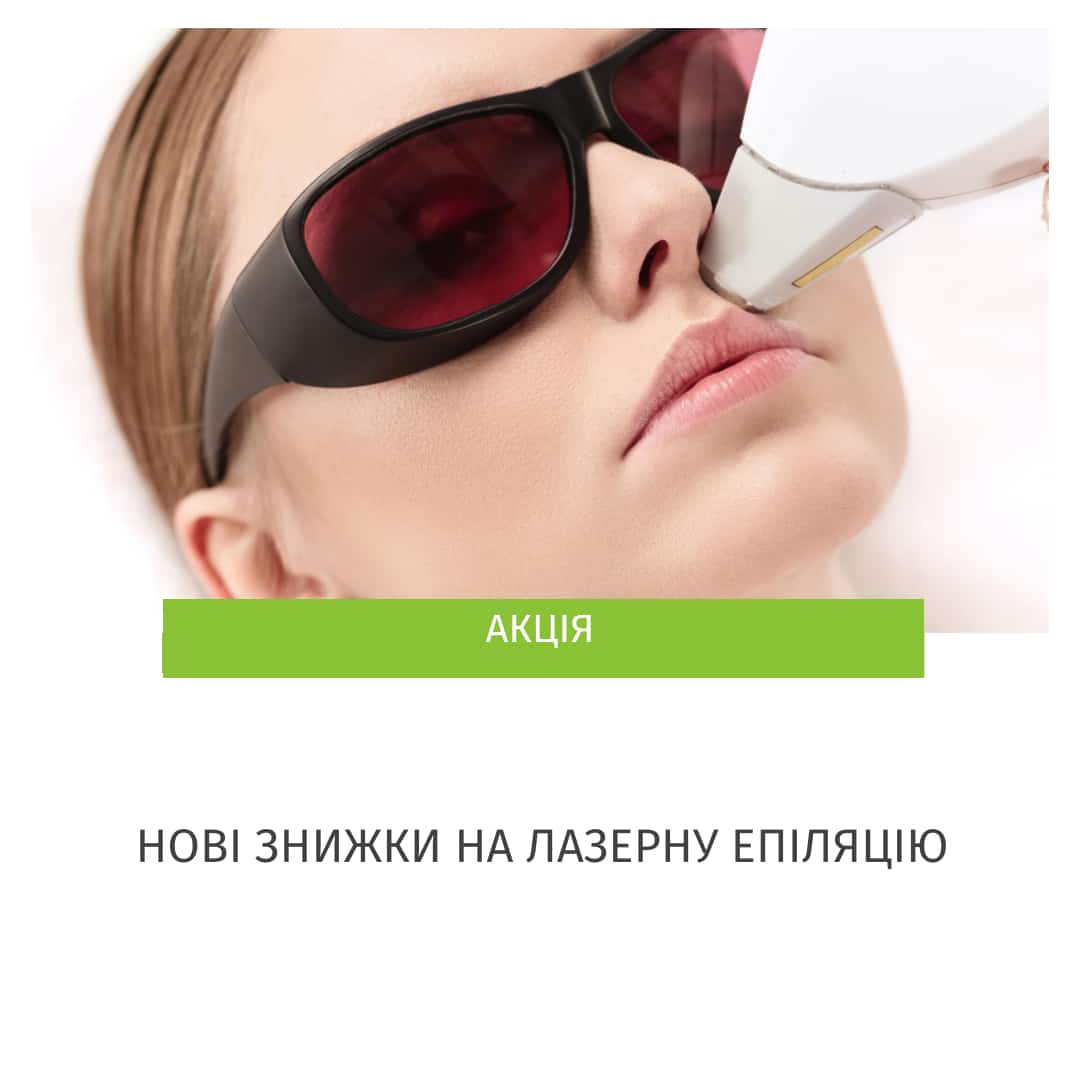 лазерна епіляція