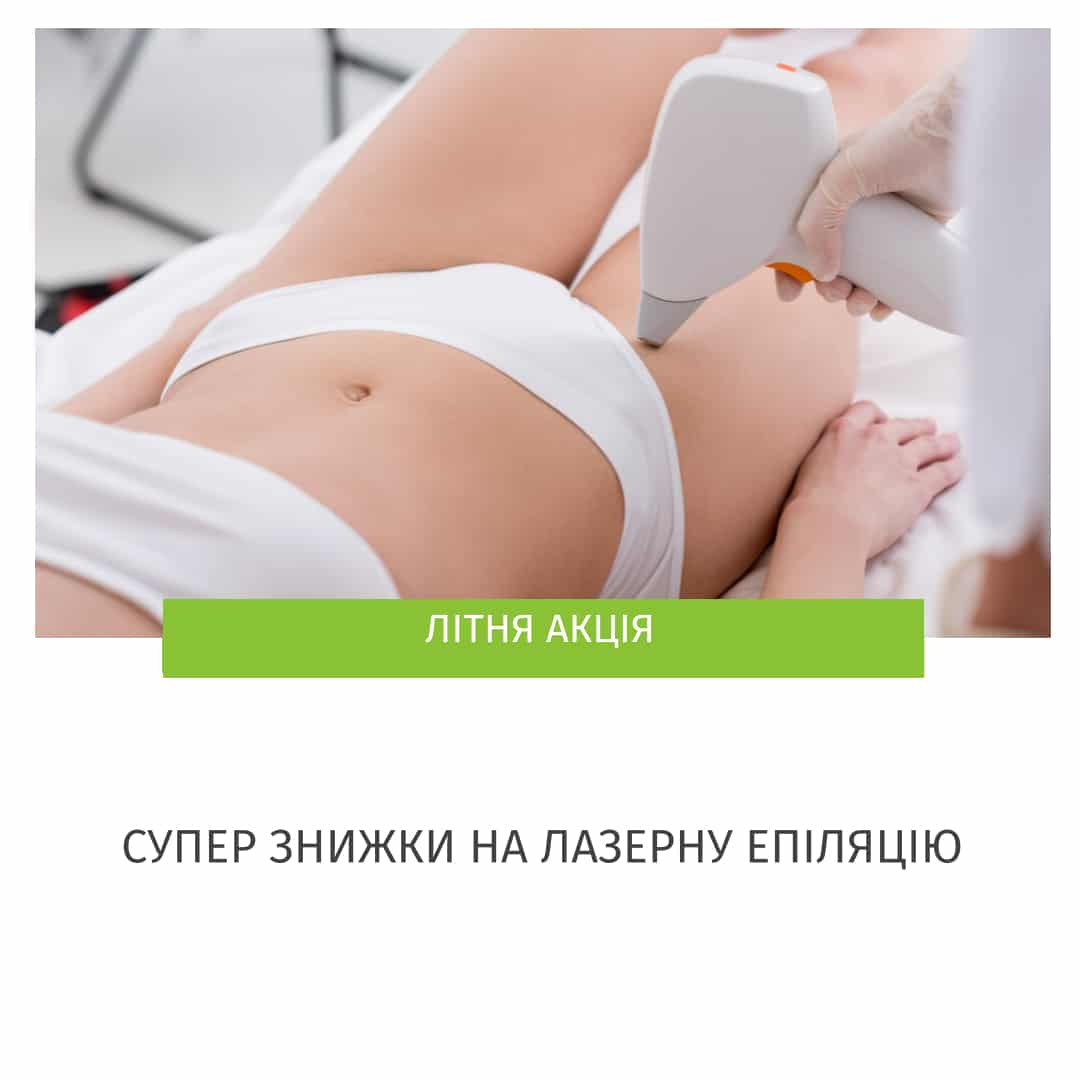 лазерна епіляція