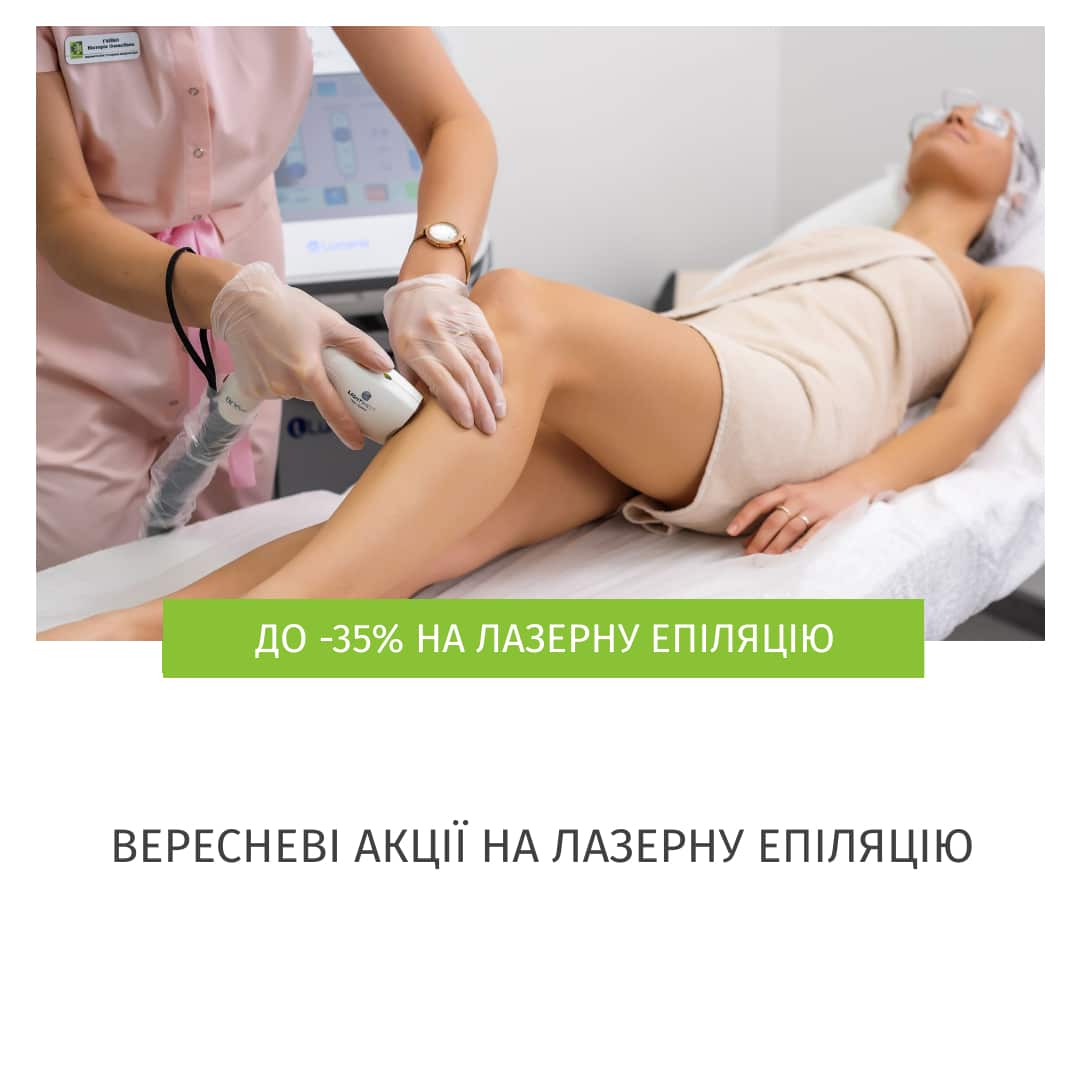 Лазерна епіляція