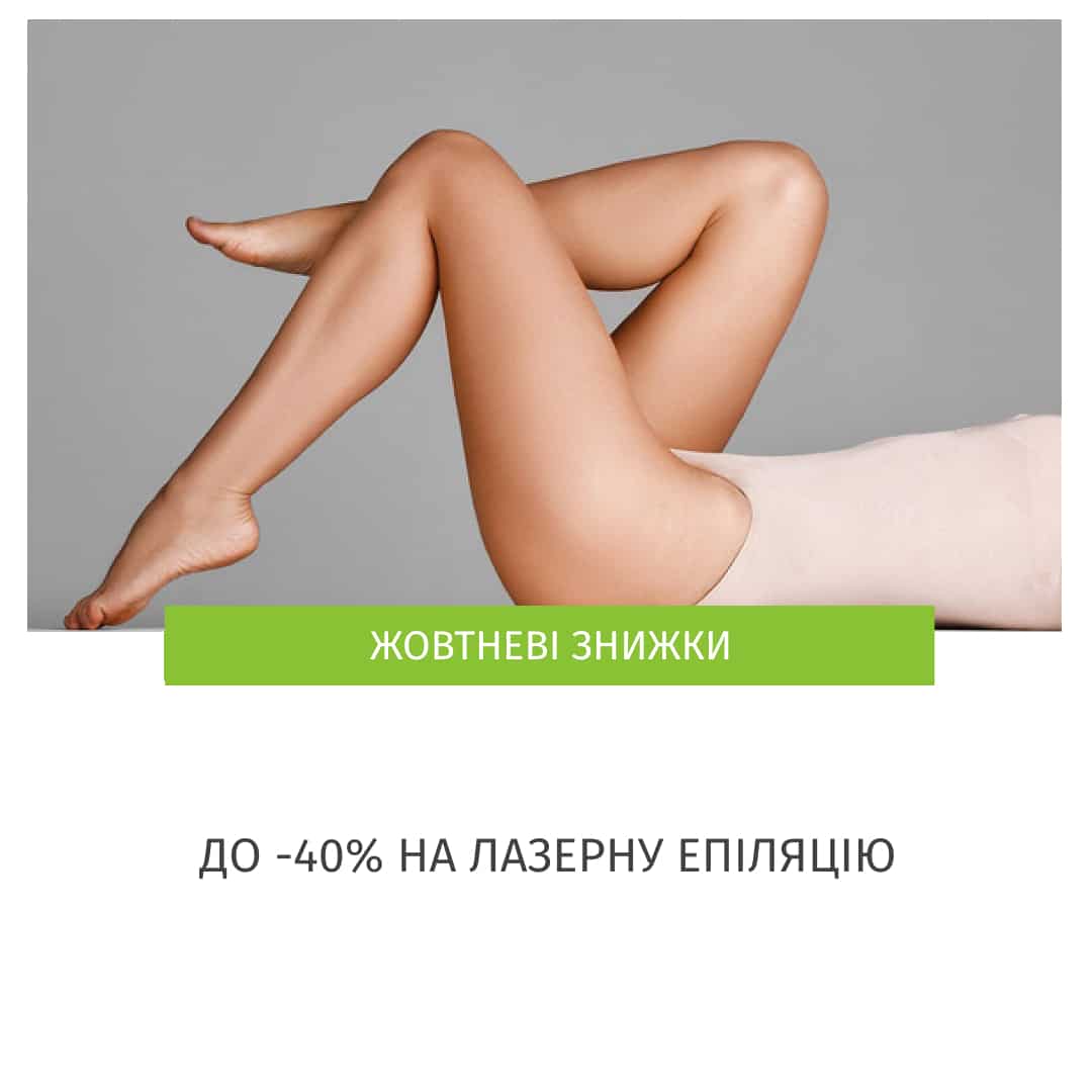 Лазерна епіляція